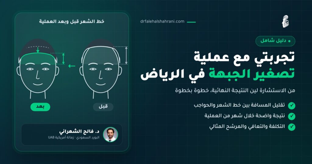 تجربتي مع عملية تصغير الجبهة في الرياض - د. فالح الشهراني